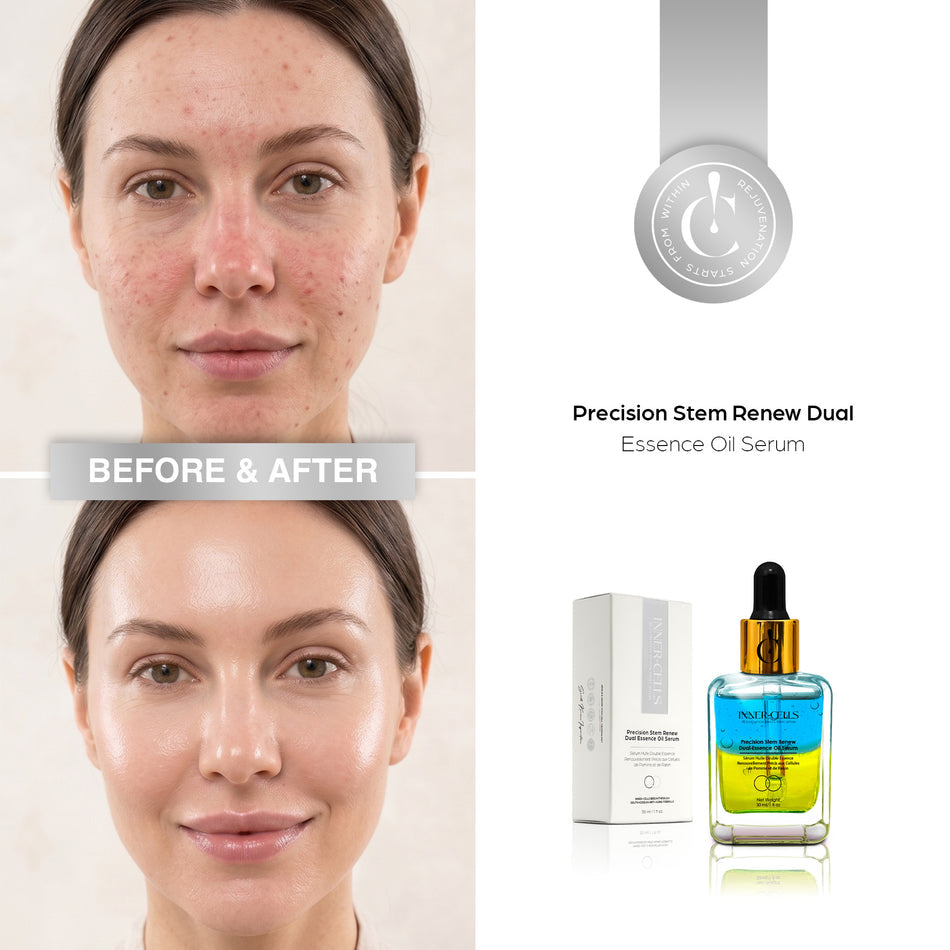 Inner Cells Precision Stem Renew Dual Essence Oil Serum